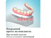 Dental-S