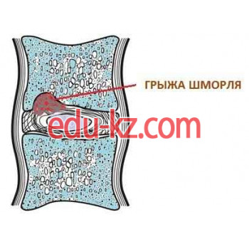 Остеопатия - Остеопат в Сочи