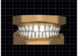 Зуботехническая лаборатория Bulks