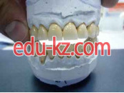 Adin Dental Implant Rus